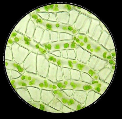 Mikroskopbilete av torvmoseblad. (Foto: Svein Gunnar R&aring;en)